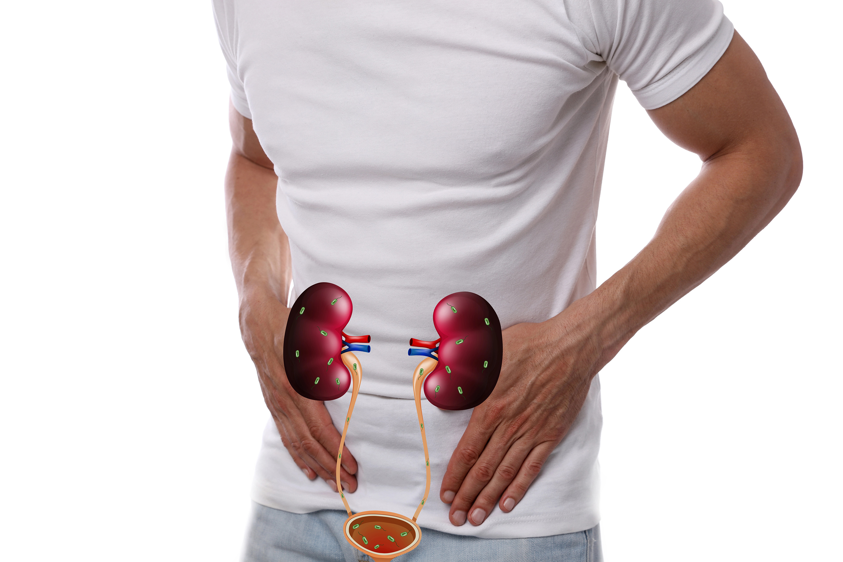 Urinary Tract Infection (UTI) Treatment Online at Urology Video Visit